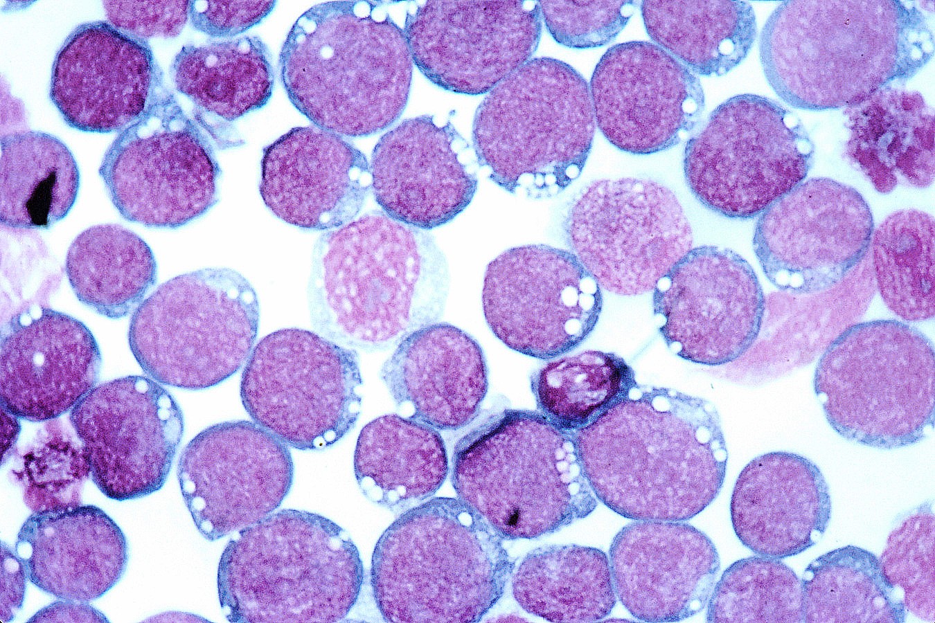 Cells stained purple on an enlarged microscope slide.